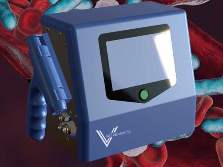 𝗔𝗱𝘃𝗮𝗻𝗰𝗶𝗻𝗴 𝗦𝗲𝗽𝘀𝗶𝘀 𝗗𝗲𝘁𝗲𝗰𝘁𝗶𝗼𝗻: 𝗧𝗵𝗲 𝗩𝗦𝗡𝗢™ 𝗕𝗿𝗲𝗮𝘁𝗵 𝗔𝗻𝗮𝗹𝘆𝘇𝗲𝗿